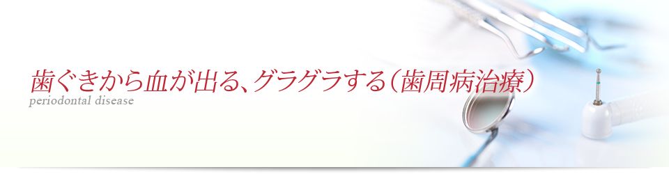 歯ぐきから血が出る、グラグラする（歯周病治療）