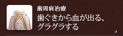 【歯周病治療】歯ぐきから血が出る、グラグラする